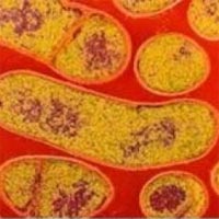 Опасные для детей бактерии ботулизма могут быть в плотно упакованных продуктах