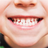 Детский врач ортодонт: что лечит и когда обращаться